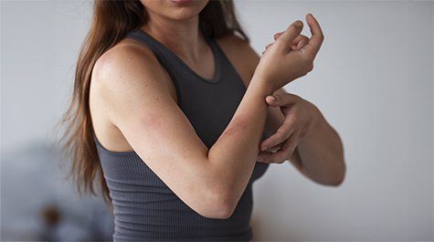 Co je dermatitida a jak poznat, že se týká právě vás