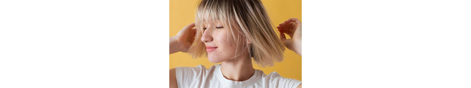 Pleť a akné v pubertě – Jak se ho zbavit?