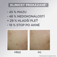 Pure Active AHA + BHA lehký denní zmatňující krém 3v1 s aktivním uhlím - 8