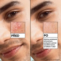 GARNIER Pure Active Salicylic Sérum proti nedokonalostem - 8