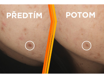 Vitamin C před a po