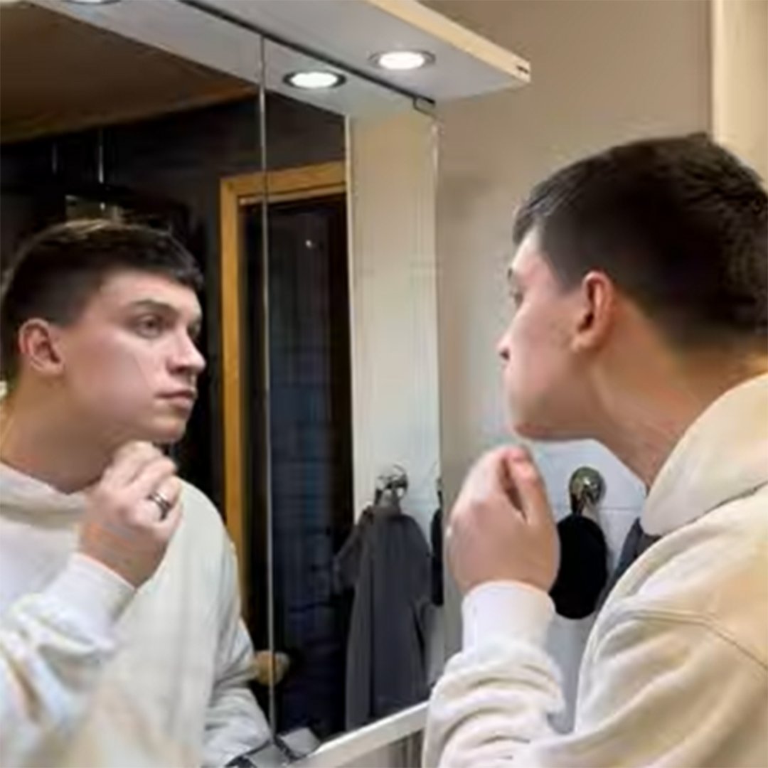 Pimple Patches Pepa